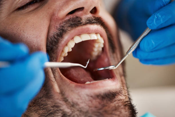 Laser Dentistry in Augusta, KY